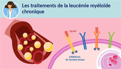 hublot leucémie traitement|les symptômes de leucémie.